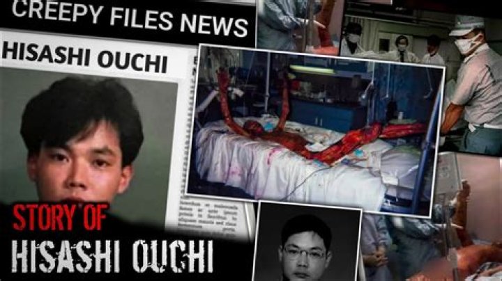 A Journey Through The Hisashi Ouchi Hospital Photos
