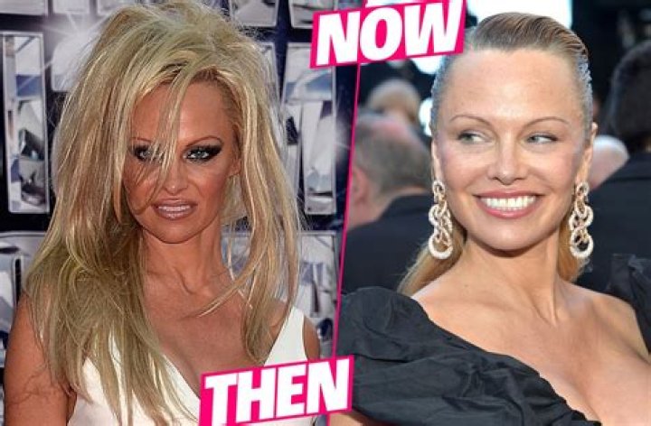 Pam Anderson Facelift Surgery- Before And After Photos ·