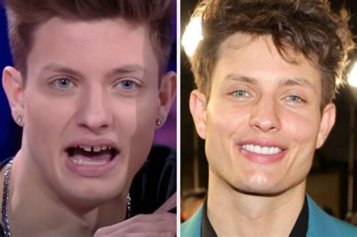 Unveiling The Enigma Of Matt Rife's Bad Teeth: Surprising Revelations