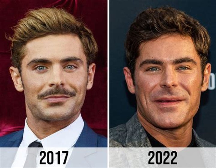Unveiling The Secrets Of Zac Efron's Plastic Surgery Journey